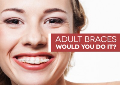 Adult Braces - Would you? Could you?