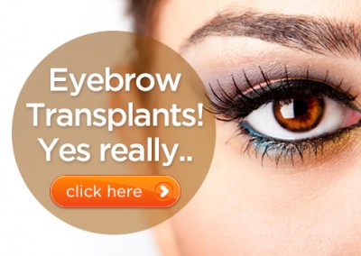 Eyebrow Transplants